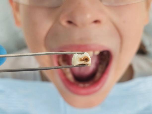 Best Emergency Dental Services for Seniors in Crest, CA